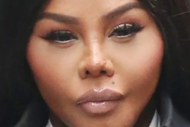 Lil Kim botched nose covered in scars 