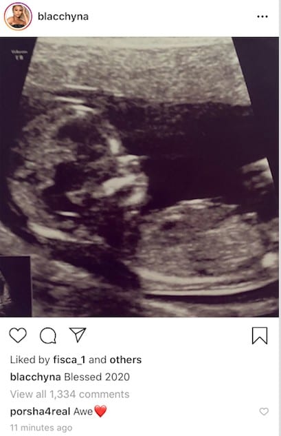 Blac Chyna Sparks Pregnancy Rumors With Ultrasound Photo On IG