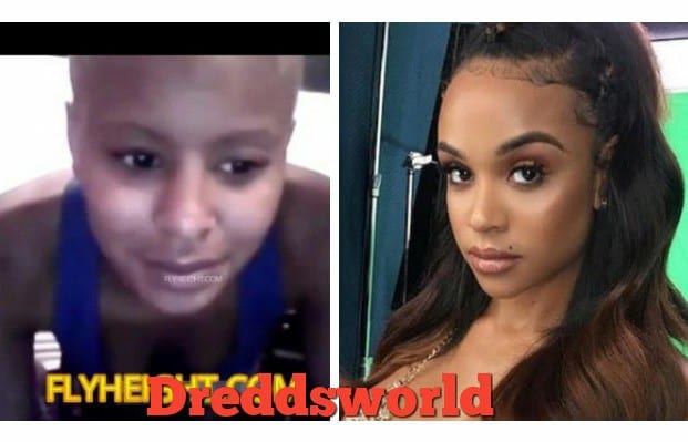 Alexis Skyy Exposed, Bald Headed & Skinny Before The Surgeries