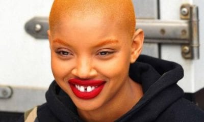 Slick Woods Suffers Injuries Mid Cancer Related Seizure 