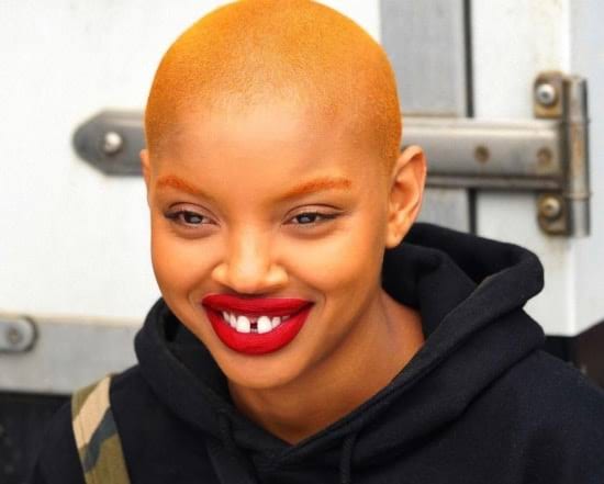 Slick Woods Suffers Injuries Mid Cancer Related Seizure 