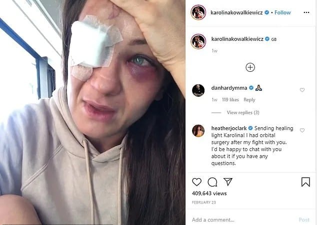 UFC Fighter Karolina Kowalkiewicz Has Skull Cracked By Brutal Head Kick