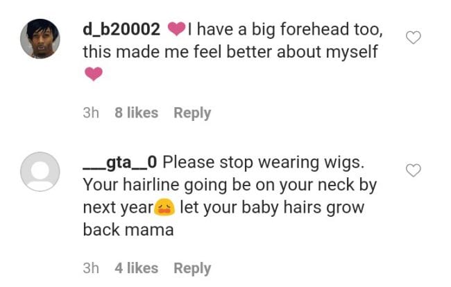 Amara La Negra Removes Afro Wig & Unveils Receeding Hairline