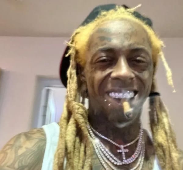 Junkie Looking Lil Wayne Worries Fans With Bald & Dusty Dreadlocks Pictures