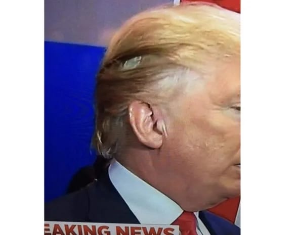 President Trump's Lacefront Wig Comes Loose During Debate