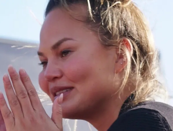 New Pics Of Chrissy Teigen Suggests She Has Botched Facelift