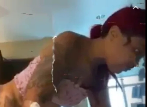 Model's Butt Implants Leaks After Falling Off 
