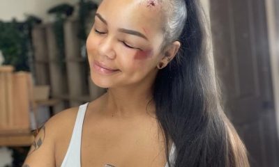 Brinda Spencer Claims Two Fat Women Jumped Her Over A Man - Badly Beaten & Her Baby Hairs Ripped Out