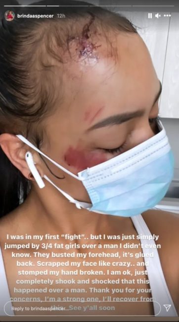 Brinda Spencer Claims 3/4 'Fat' Women Jumped Her Over A Man - Badly Beaten & Her Baby Hairs Ripped Out