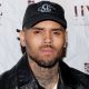 Pictures Of Chris Brown's Dog Attack Victim Surface Online