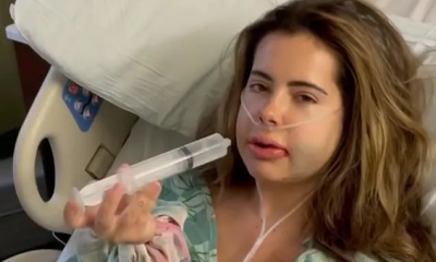 RHOA's Brielle Biermann Gets Chin & Jaw Transformation Surgery