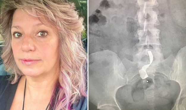 Woman Turns Down Airforce $50,000 Offer  After A Towel Was Left Inside Her After A C-Section
