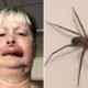 Virginia Woman Hospitalized For Brown Recluse Spider Bite After Kayaking Down Staunton River