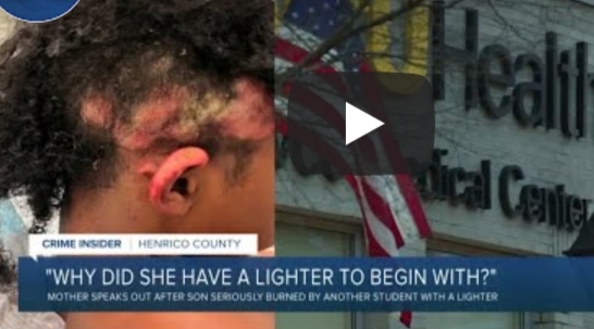 Teen Charged For Allegedly Setting Classmate's Hair On Fire During Lunch  