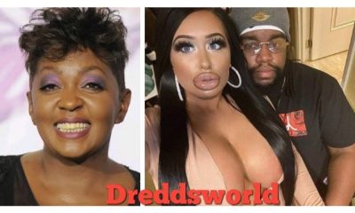 Anita Baker's Son Walter Dating IG Model With Numerous Plastic Surgery 