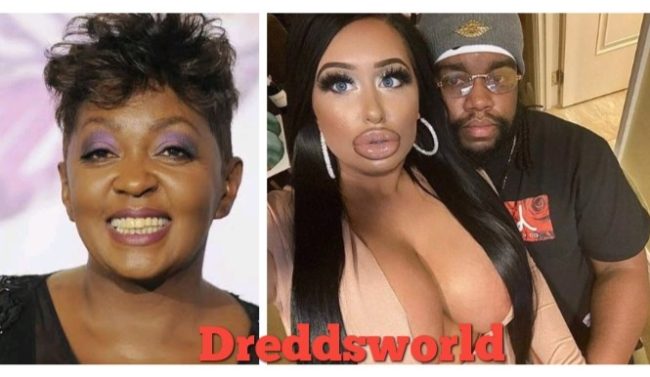 Anita Baker's Son Walter Dating IG Model With Numerous Plastic Surgery 