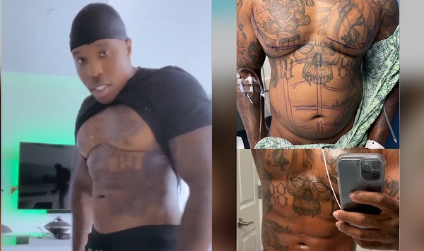Bandman Kevo Calls Out Other Rappers After Revealing His Ab & Waist Liposuction Results