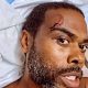 Lil Duval Airlifted To Hospital After His ATV Got Hit By Car In Full Speed