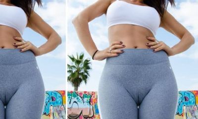 Tight Leggings Causing Women To Purchase A 'Designer Vagina' Because It's Uncomfortable & Embarrassing Due To Camel Toe