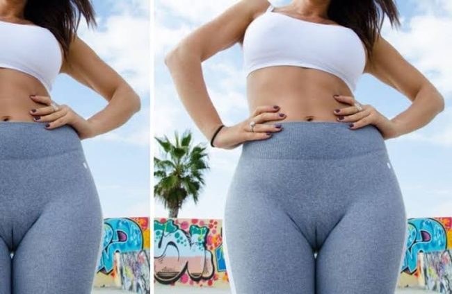 Tight Leggings Causing Women To Purchase A 'Designer Vagina' Because It's Uncomfortable & Embarrassing Due To Camel Toe