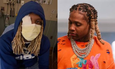 Lil Durk Recovers After Sustaining Eye Injury From Explosion On Stage At Lollapalooza