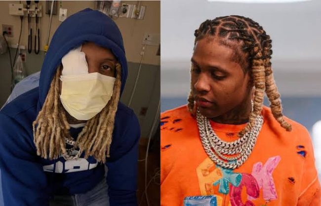 Lil Durk Recovers After Sustaining Eye Injury From Explosion On Stage At Lollapalooza