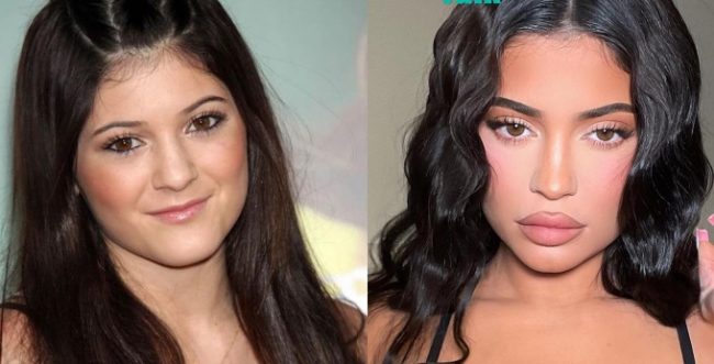 Kylie Jenner Says A Big Misconception About Her Is That She's Had So Much Surgery On Her Face