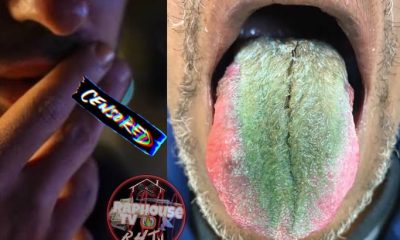 Ohio Man's Tongue Sprouts Green Hair After Years Of Smoking Cigarette