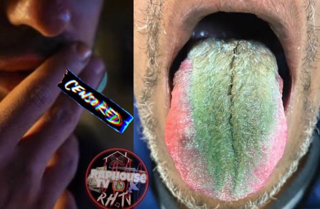 Ohio Man's Tongue Sprouts Green Hair After Years Of Smoking Cigarette