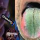 Ohio Man's Tongue Sprouts Green Hair After Years Of Smoking Cigarette