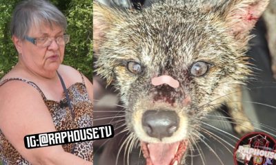 Woman Bites Rabid Fox To Escape