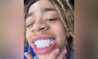 King Harris Gets Clowned After Showing Off His New Veneers, He Fires Back