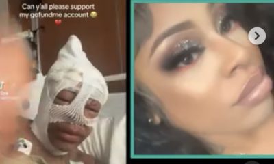 Woman Screams In Pain After Having To Undergo Multiple Surgeries Because Her Sister Threw Acid On Her