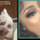 Woman Screams In Pain After Having To Undergo Multiple Surgeries Because Her Sister Threw Acid On Her