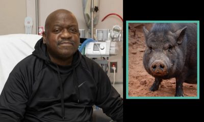 Black Man Receives World's First Genetically-Edited Pig Kidney Transplant: "He Is Recovering Well"