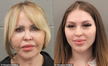 Botched Faced Mom & Daughter Duo Arrested For Selling Illegal Butt Injections