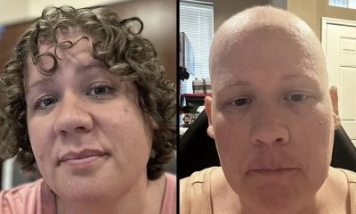 Woman Who Underwent Chemotherapy After Being Given 15 Months To Live Finds Out She Never Had Cancer, Doctor Congratulated Her Instead of Apologizing