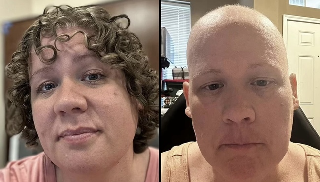 Woman Who Underwent Chemotherapy After Being Given 15 Months To Live Finds Out She Never Had Cancer, Doctor Congratulated Her Instead of Apologizing